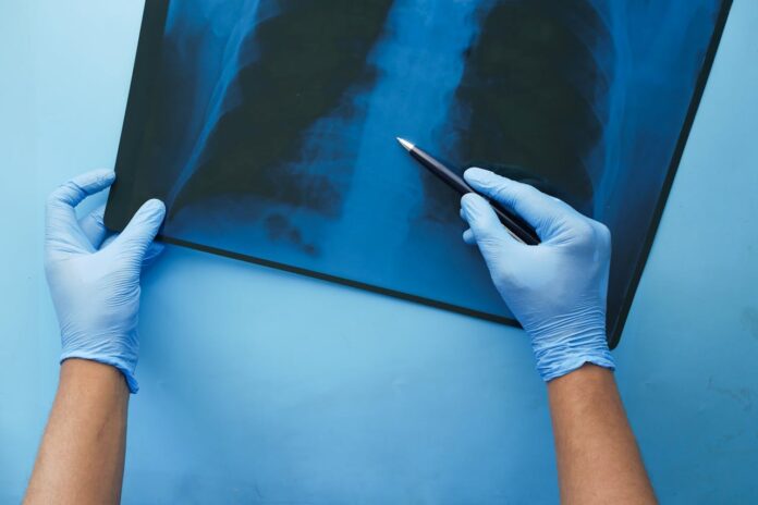 car wrick injusry xray of spine