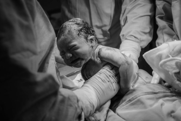 Doctor examining newborn for signs of birth injuries.