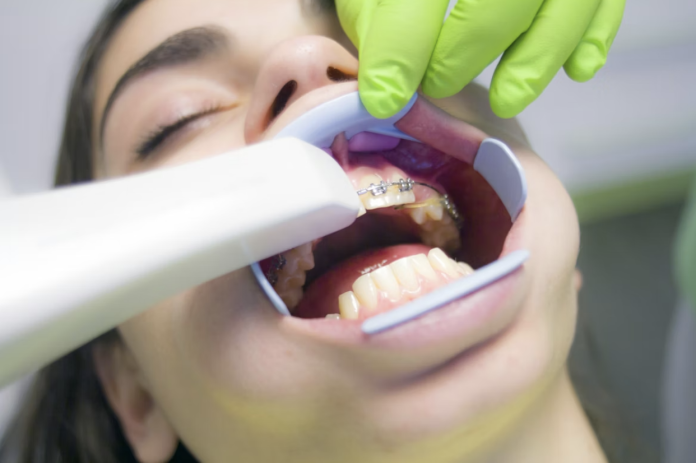 Screen Shot 2026-06-15 at 10.18.58 AM Child receiving early orthodontic treatment with braces during a dental examination to support healthy jaw development and proper tooth alignment.
