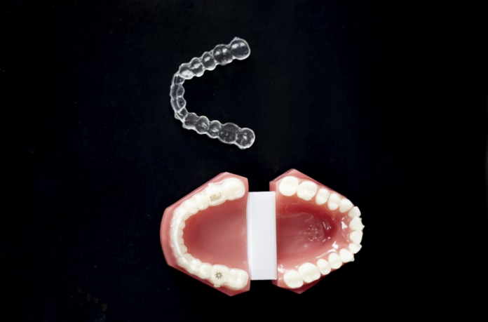 Clear Invisalign aligner displayed above a dental model illustrating removable orthodontic treatment for straighter teeth.